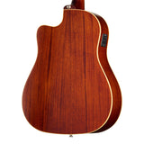Epiphone J-45 Standard EC Acoustic Electric Guitar - Honey Burst